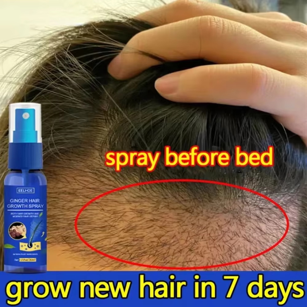 Hair Care Hair Serum - 速効性ジンジャーヘアグローススプレー、毛根育成、脱毛防止、育毛セラム、頭皮ダメージ修復、栄養ケア製品、女性男性用