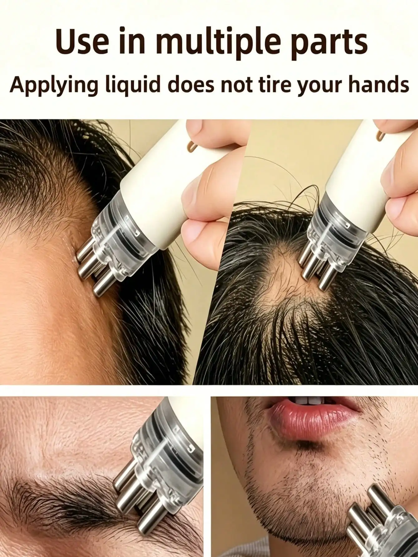 Hair Care Hair Serum - 頭皮アプリケーター トラベルキャパシティヘアグロースセラムガイドコームローラーボールアプリケーター、ポータブル頭皮アプリケーターコーム、速度調整可能なヘアケアマッサージコーム、頭皮マッサージツール、頭皮を滑らかにする、プロのヘアスタイリングツール、適切なツール